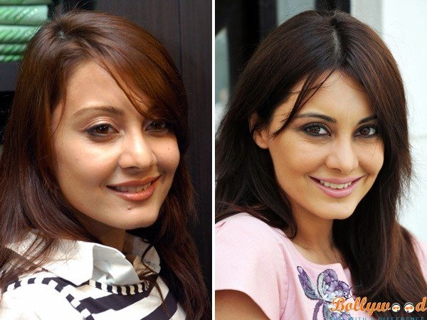 Minissha Lamba plastic surgery before and after