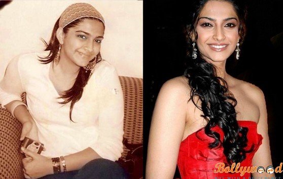 Sonam Kapoor before and after