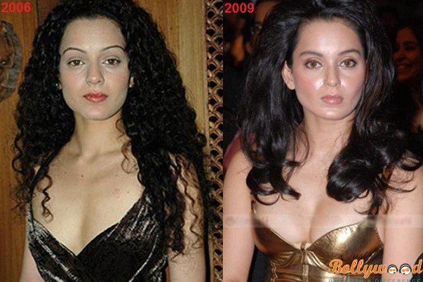 kangana ranaut plastic surgery before and after