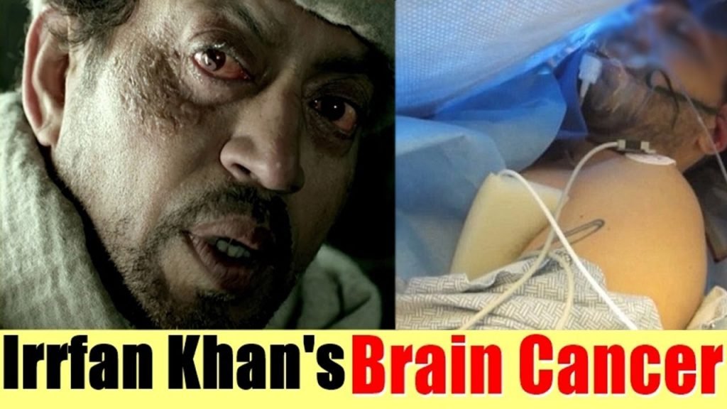Irrfan Khan is suffering from Brain Cancer